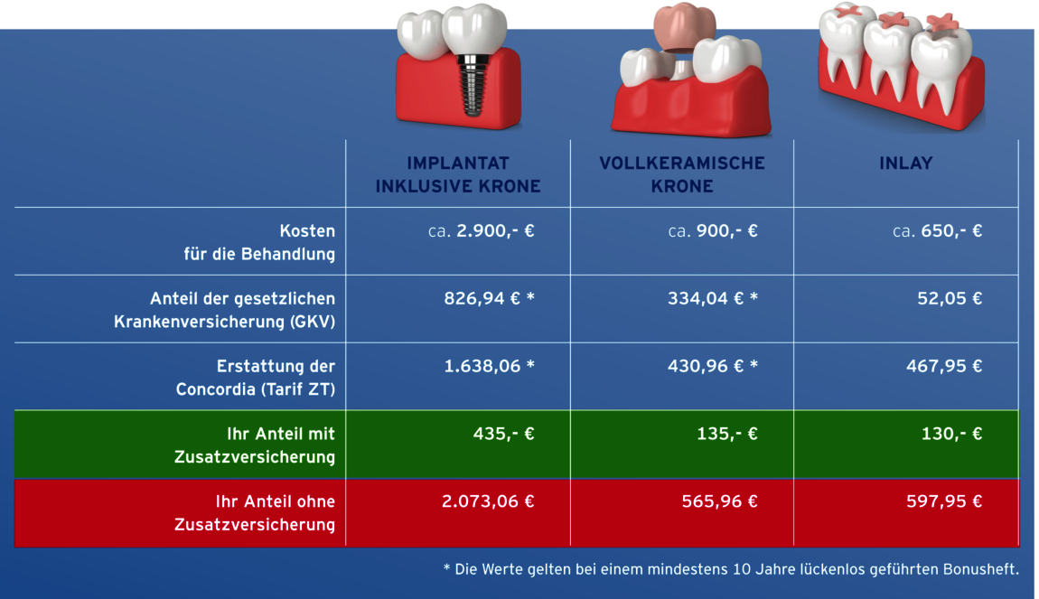 Die Grafik zeigt Kosten und Zuschüsse der Concordia für Zahnersatz